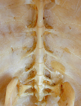 Close-up of fused backbone and ribs